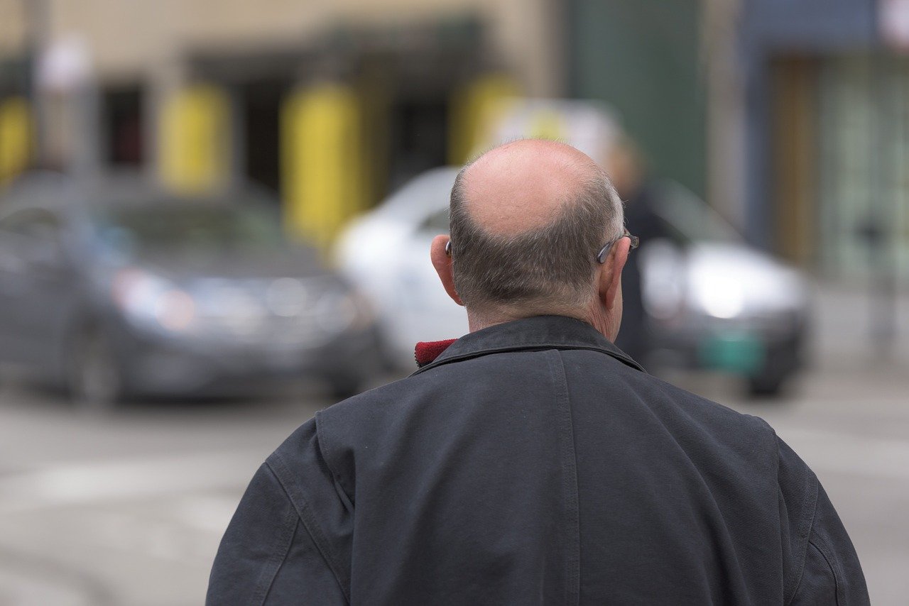 greffe de cheveux