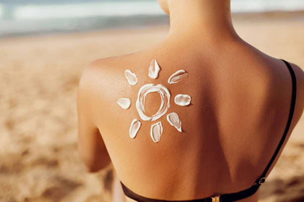 apaiser un coup de soleil