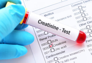 créatinine
